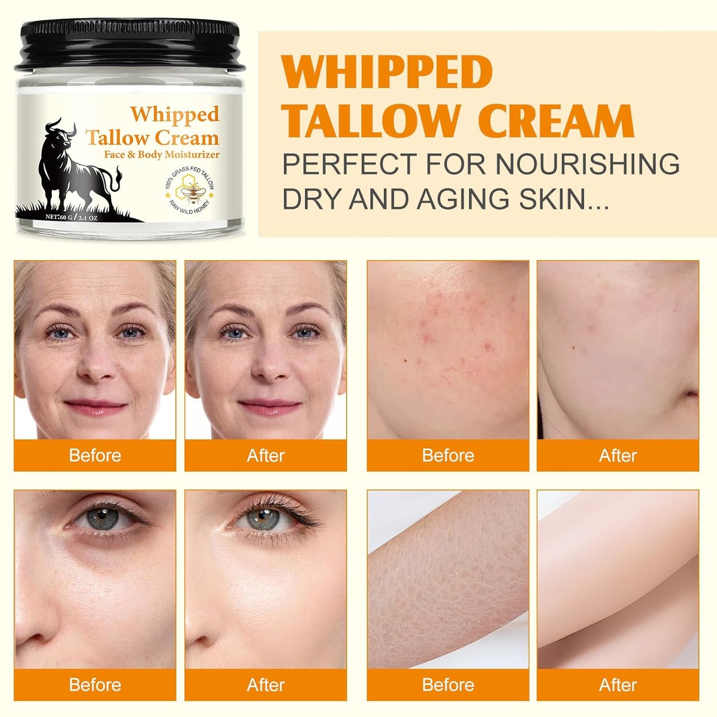 Beef Tallow Skincare, 120G Rindertalg Honig Balsam, Natürliche Talg & Honig Rindertalg Creme, Beef Tallow Bio, Tallow Creme Für Feuchtigkeitsspendend & Anti-Ageing, Tallow Balm Für Gesicht & Körper