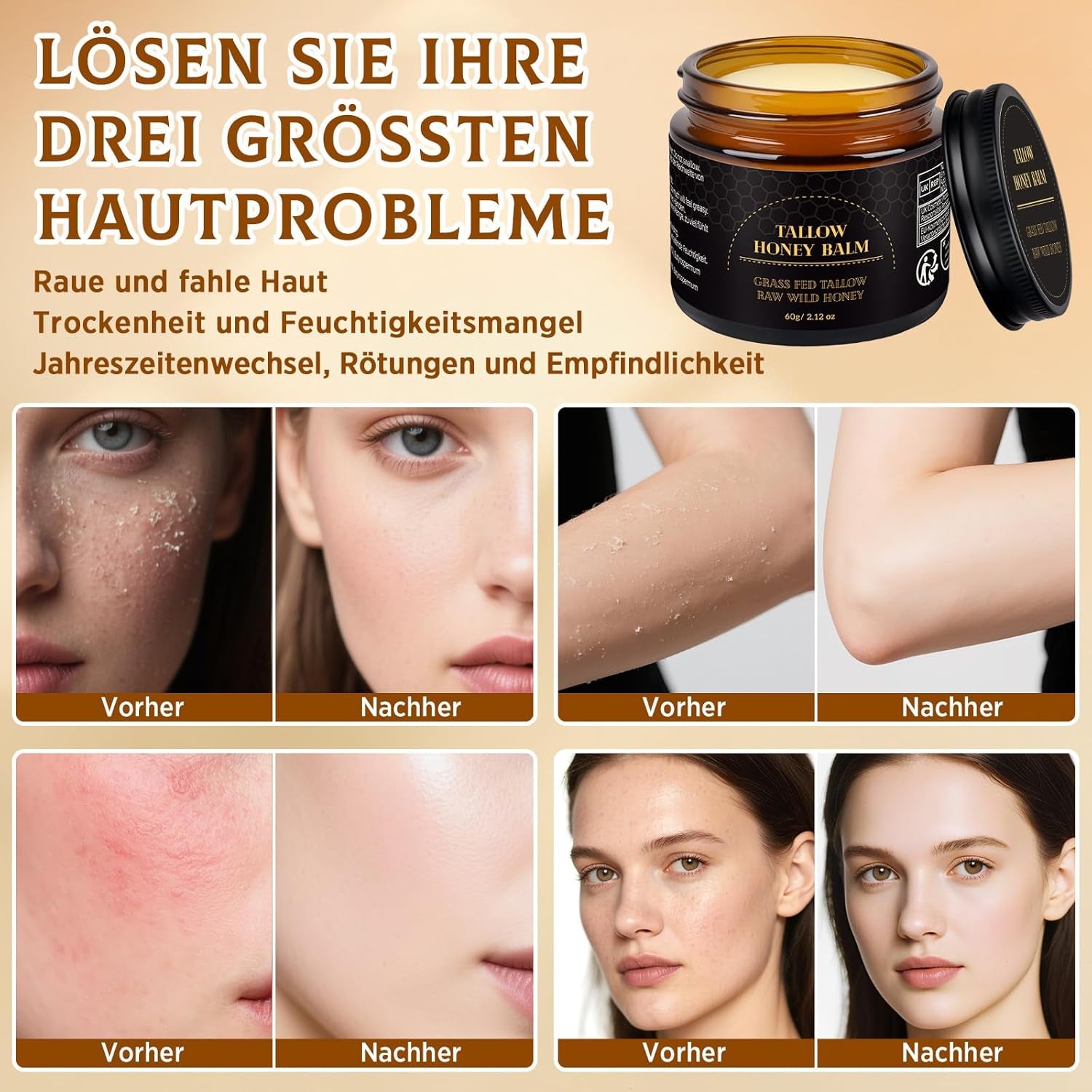 Beef Tallow Creme, Rindertalg Creme, Tiefe Hydratation & Feuchtigkeitscreme, Gefütterter Rindertalg Und Honigbalsam Für Empfindliche, Trockene Haut, Beef Tallow Honey Balm 60G