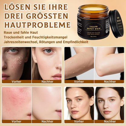 Beef Tallow Creme, Rindertalg Creme, Tiefe Hydratation & Feuchtigkeitscreme, Gefütterter Rindertalg Und Honigbalsam Für Empfindliche, Trockene Haut, Beef Tallow Honey Balm 60G